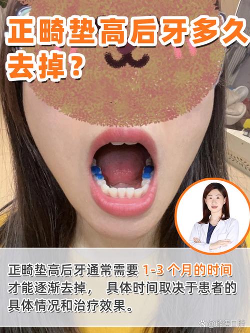 牙齿矫正还能吹号吗_牙齿矫正还能当兵吗_38岁了还能不能牙齿矫正