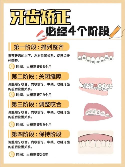 成人牙齿矫正反颌多少钱_成人牙齿反颌矫正_成人牙齿矫正反颌怎么办