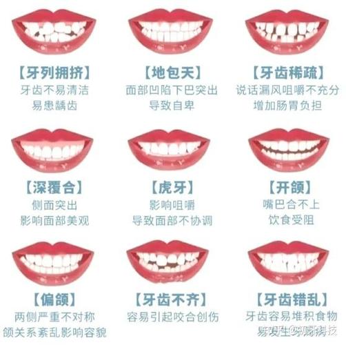 做牙齿矫正要好多钱_24岁做牙齿矫正多少钱_牙齿矫正钱做什么用