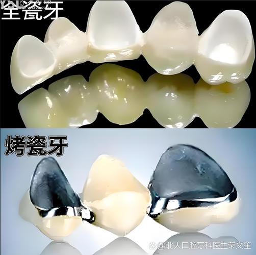 老人种牙有优惠吗_老人种牙满口多少钱种一颗_老人满口种牙费用贵吗