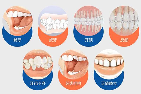 合肥隐形牙齿矫正费用贵不贵？要多少钱？