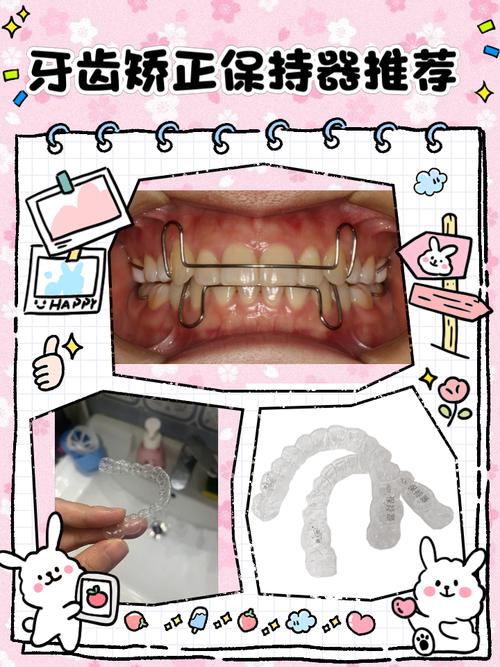 u=238320726,3675213458&fm=253&fmt=JPEG&app=138&f=JPEG.jpg u=238320726,3675213458&fm=253&fmt=JPEG&app=138&f=JPEG.jpg