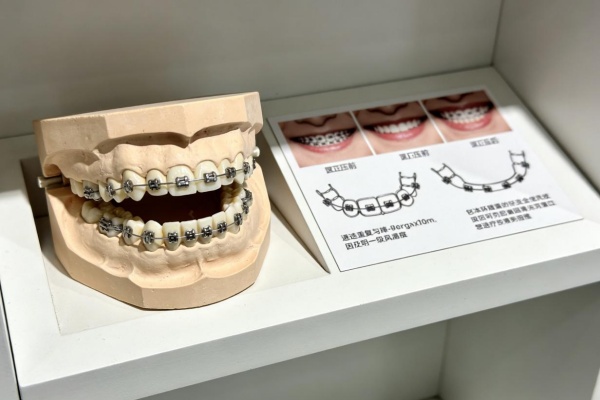 2026矫正牙齿价格表|从8k到8w,不同方式费用明细全解析