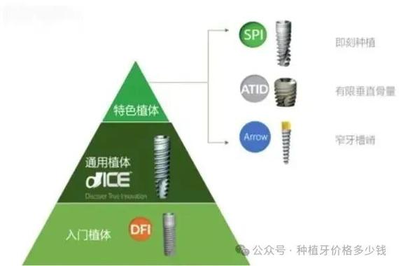 晋中国产种植牙品牌 莱顿价格_北京莱顿种植体价格_国产手表品牌排名及价格
