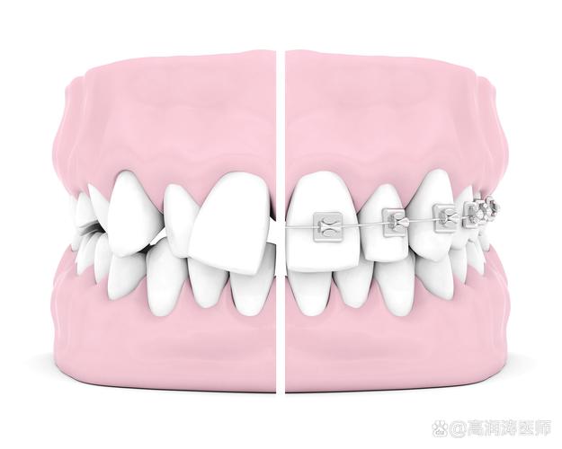 成人还能做牙齿矫正_矫正牙齿成年可以做吗_成人牙齿矫正还能做磁共振吗