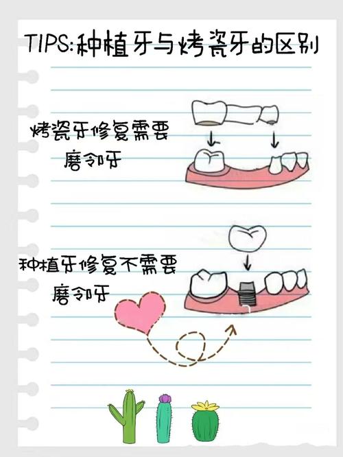 种植牙和假牙_种植牙和假牙区别_假牙和种植牙有什么区别