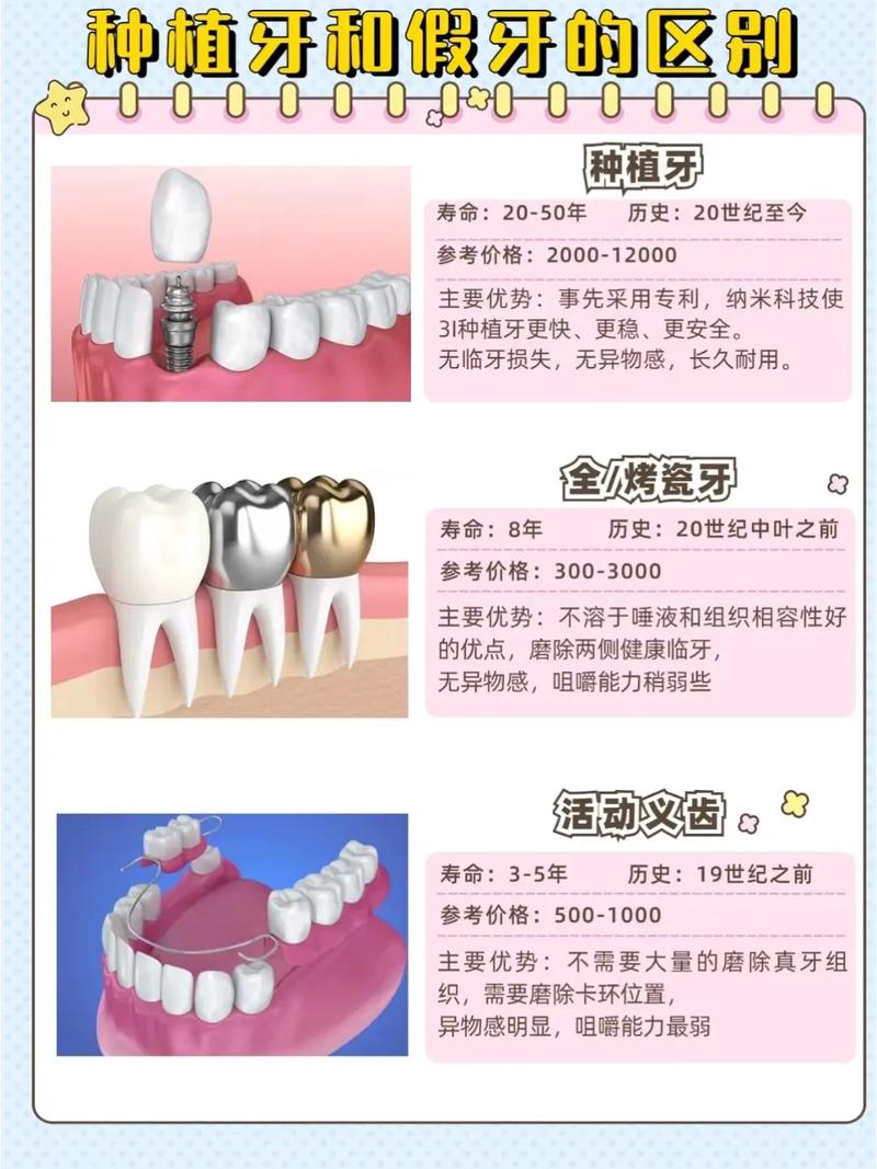 假牙和种植牙有什么区别_种植牙和假牙区别_种植牙和假牙