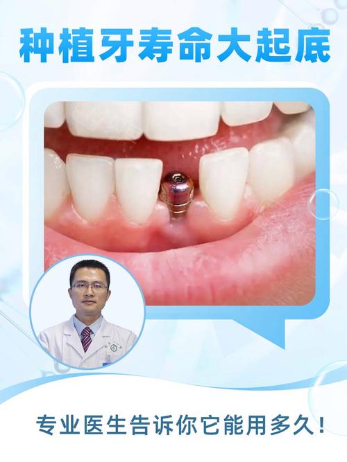 上门牙种植风险大吗_上门牙种牙_种上门牙多少钱一颗啊