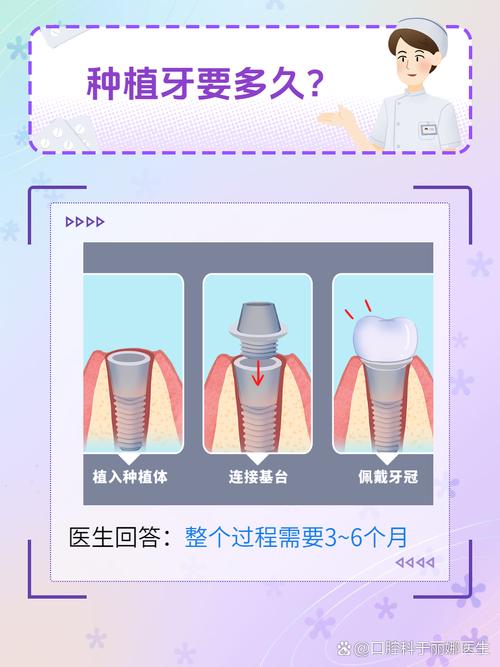 种上门牙多少钱一颗啊_上门牙种牙_上门牙种植风险大吗