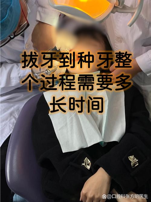 种植牙可以拔了就种吗_拔牙一个月能种植牙_拔牙即可种植