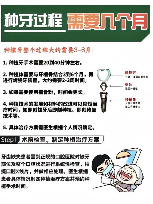 全口种植牙需要多久完成_牙种植口完成需要多久_牙种植口完成需要多长时间