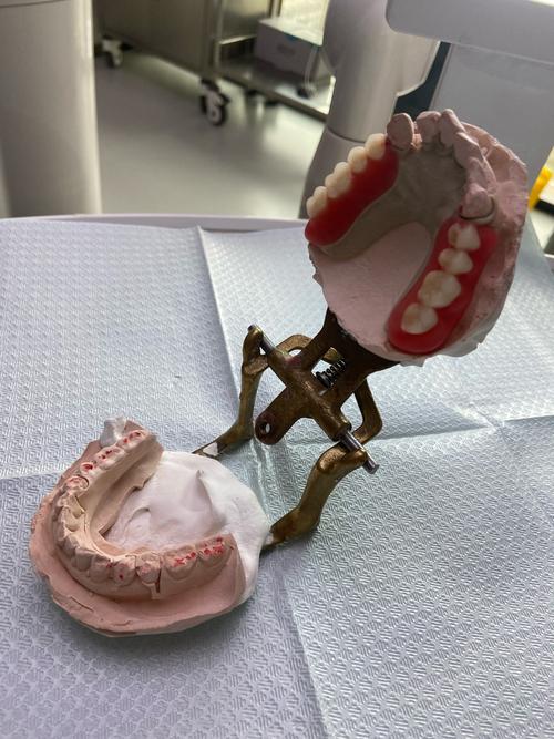 没有牙齿除了种牙还有什么办法_没有种牙的条件怎么办_怎样种牙没事