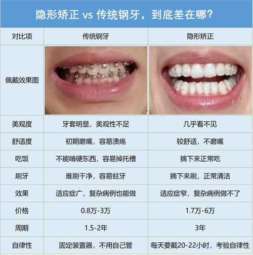 7天矫正牙齿要多少钱_牙齿矫正要天天去医院吗_牙齿矫正钱是一次付清吗