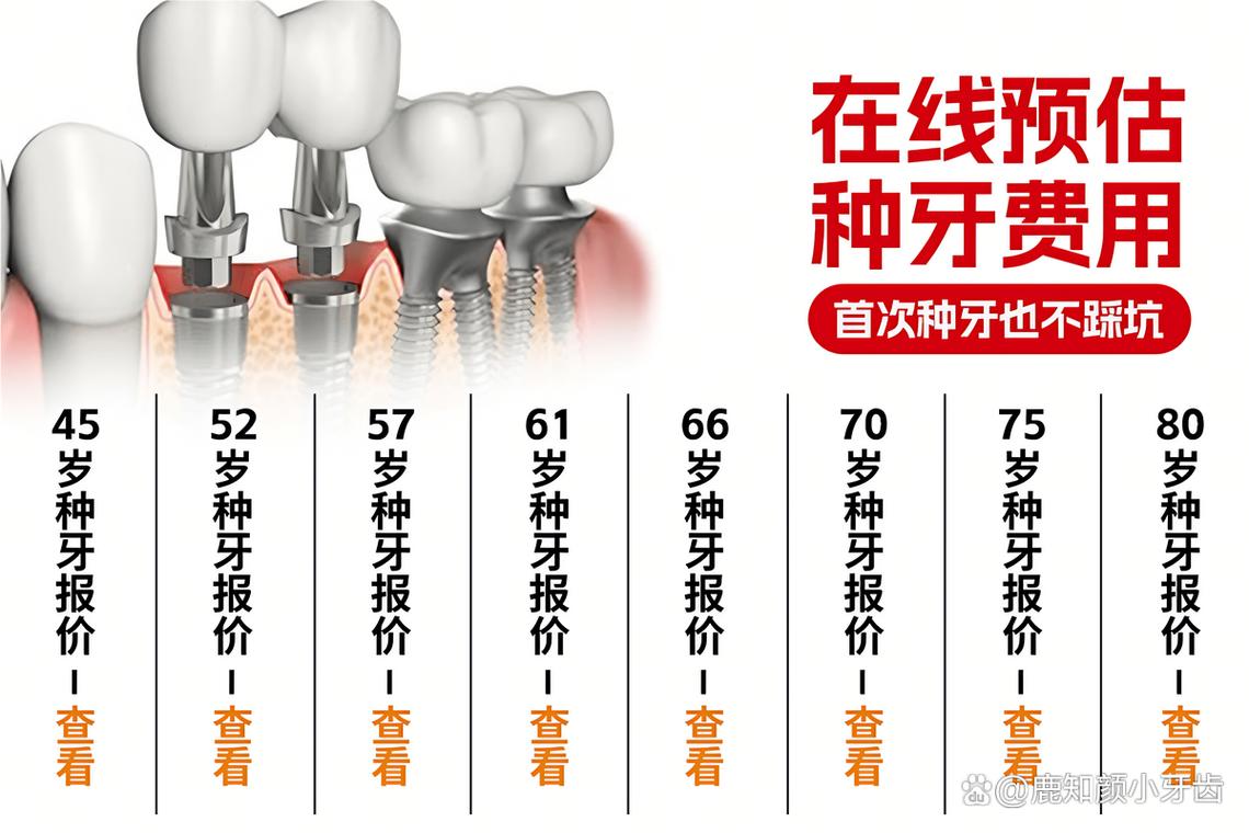 种植牙多少钱一颗北京_种牙价格北京_北京一棵种植义牙多少钱