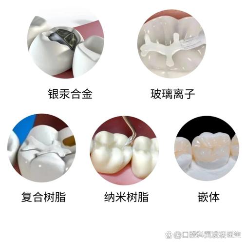 补牙用什么材料好？哪种补牙材料最靠谱？