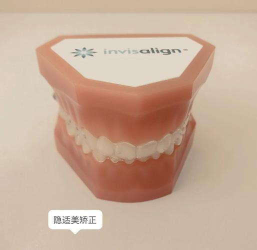 深圳牙缝过大矫正多少钱 明细与避坑指南