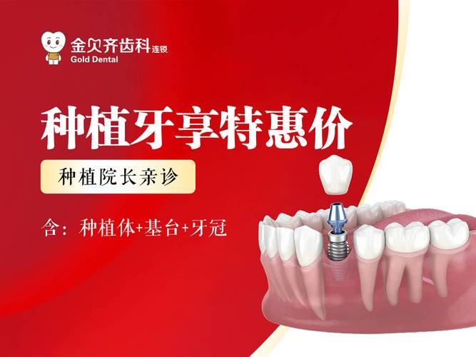 承德口腔医院种植牙价格_承德种牙多少钱一颗啊_承德种牙医院