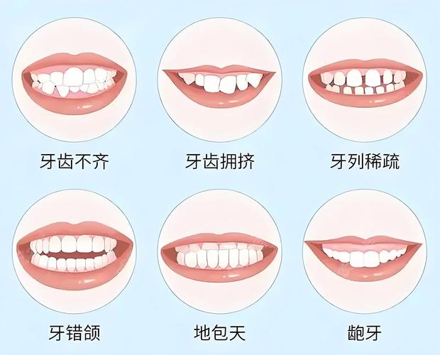 牙齿矫正弊利的原因_20岁矫正牙齿的利与弊_牙齿矫正利大于弊吗