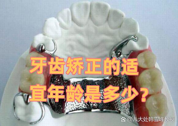矫正牙齿多少岁合适_几岁做牙齿矫正合适_牙齿矫正合适的年龄