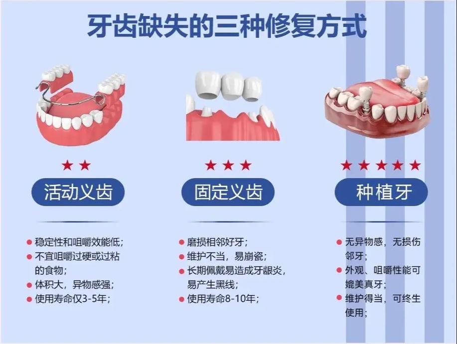 缺牙不种牙还有哪些靠谱的修复方法