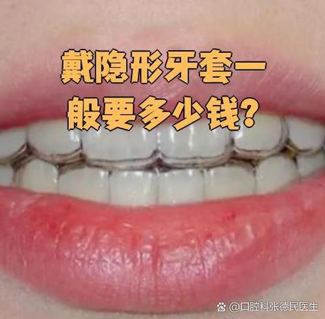 口腔医院隐形牙套_松岗隐形牙套收费_隐形牙套成本价是多少钱一副