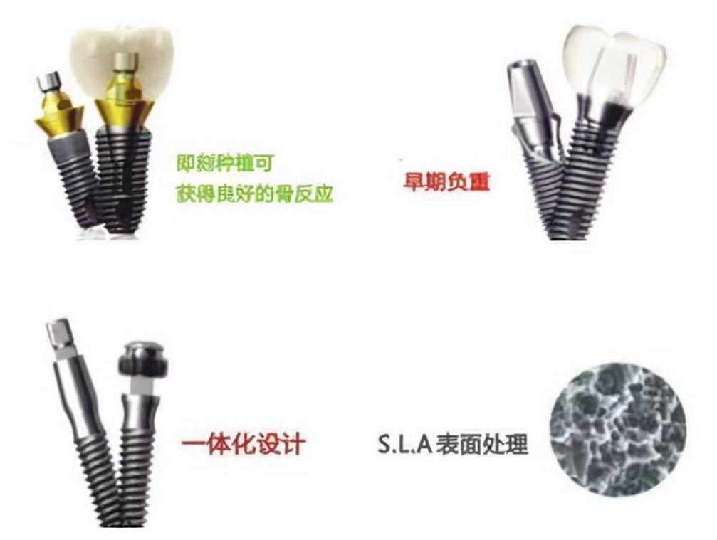 东莞种植牙价格_东莞种植牙 2026 价格 2980 元起 镇街性价比_东莞种植牙最贵三个地方
