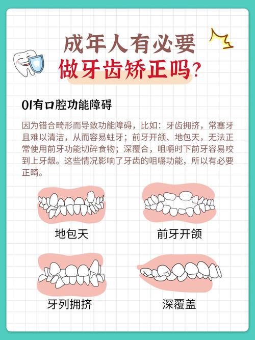 40岁做牙齿矫正来得及吗 牙医告诉你真实答案