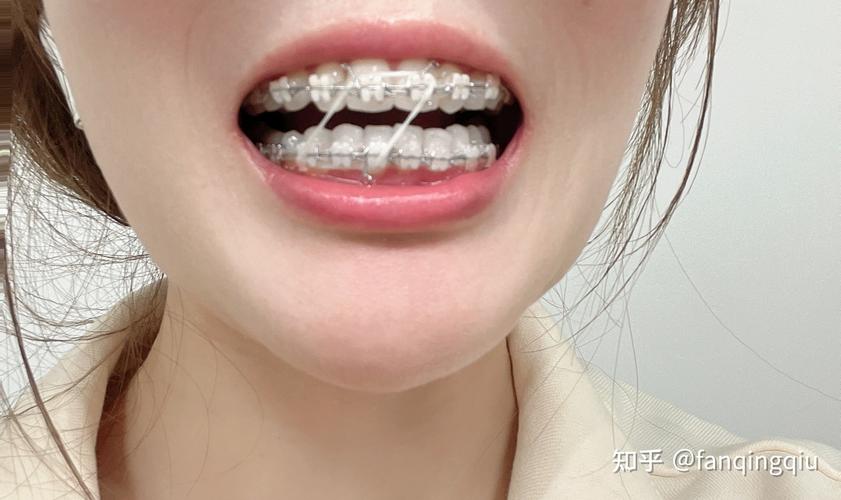 27岁做牙齿矫正还来得及吗