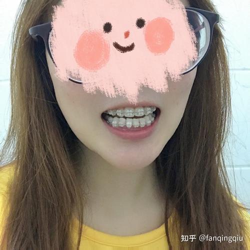 27岁能牙齿矫正吗_牙齿矫正能改变脸型吗_牙齿矫正能不能用医保