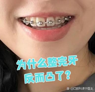 50岁门牙突出可矫正吗_门牙突出矫正需要多长时间_矫正突出门牙可以矫正吗