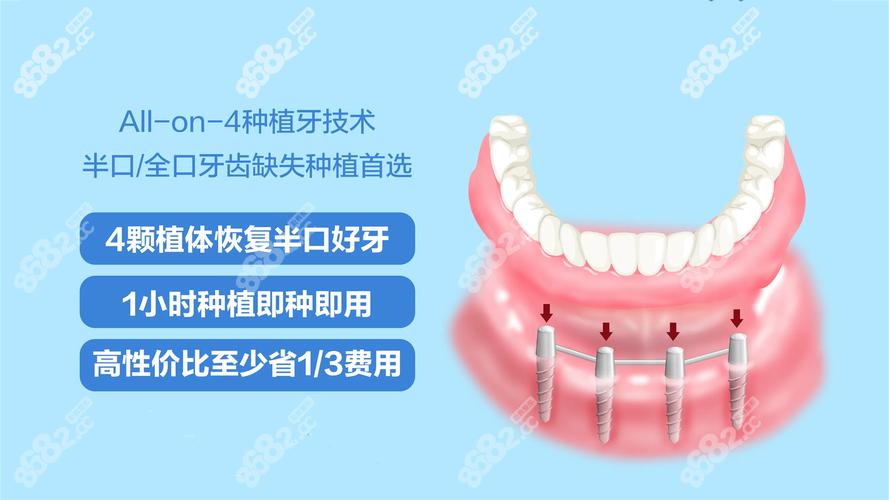 种植后牙一颗多少钱_半口牙种植4颗牙_满口种植牙以后