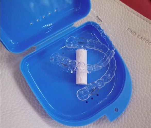 成都钢丝矫正牙齿需要多少钱_牙齿矫正钢丝每个月都要换吗_牙齿矫正钢丝选哪种更省心