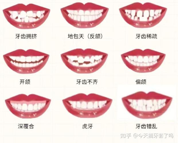 矫正牙齿的时候可以整容吗_牙齿矫正能_25岁还可以做牙齿矫正吗