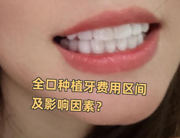 深圳罗湖骨量不足全口种牙大概多少钱