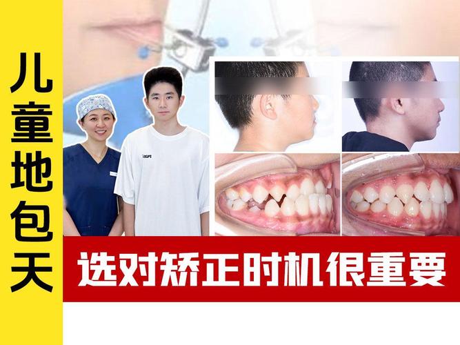小孩地包天_地包天牙齿儿童_孩子牙齿地包天矫正费用