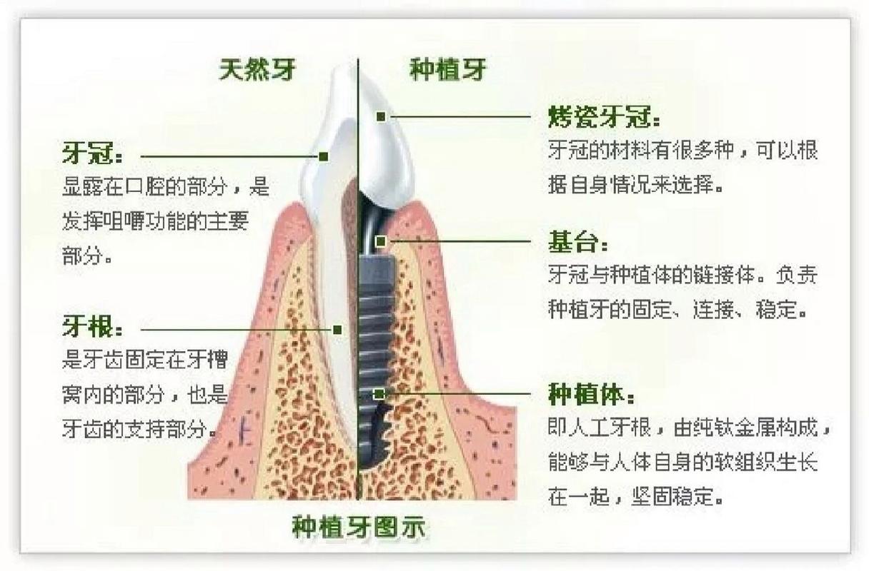 重庆种植牙医院_牙种植重庆医院能报销吗_牙种植重庆医院哪家好
