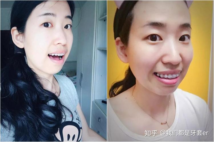 方得人心的意思_30岁以上可以做牙齿矫正吗_月经期喝冰的会怎样