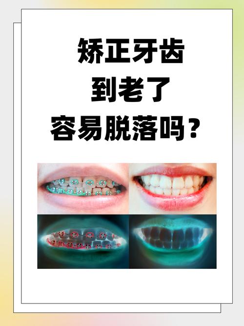 43岁矫正牙齿晚不晚 过来人告诉你答案