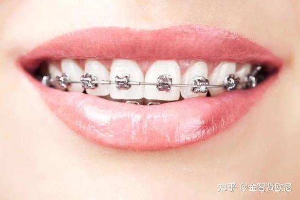 牙齿矫正保什么保险_牙齿矫正的费用包括保持器吗_保山牙齿矫正哪里好