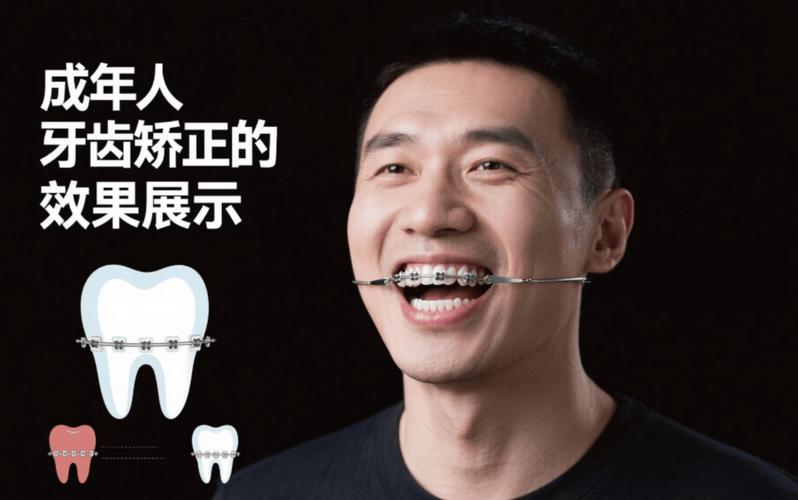 牙齿矫正价格表2025_牙齿矫正价格一般是多少_矫正牙齿一般价格是多少