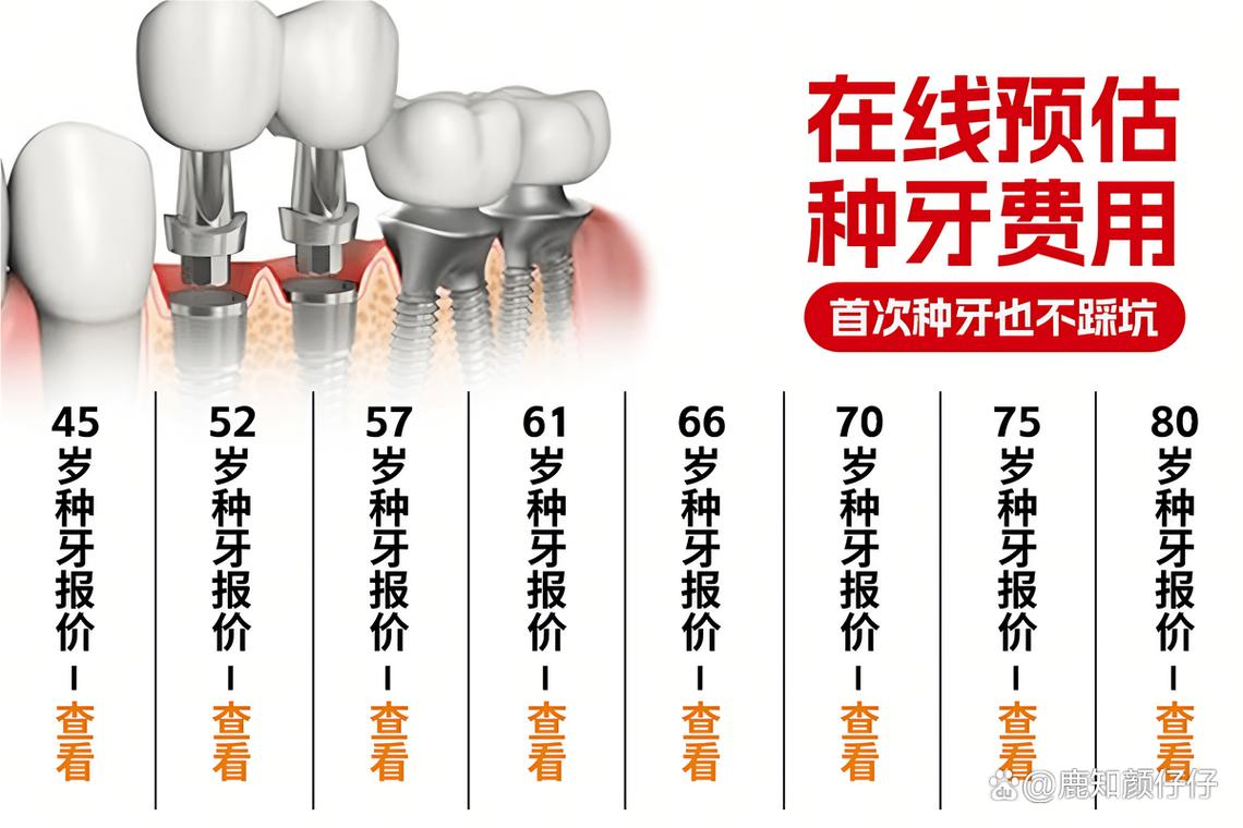 诺贝尔门诊牙种植深圳价格表_诺贝尔种植牙售后服务电话_深圳诺贝尔种植牙门诊价格