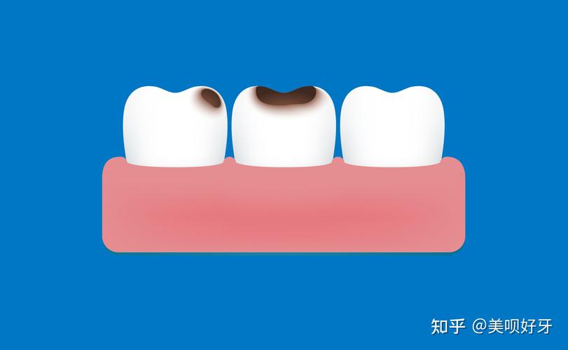 24岁能牙齿矫正吗_牙齿矫正能只矫正上面吗_牙齿矫正能走医保吗