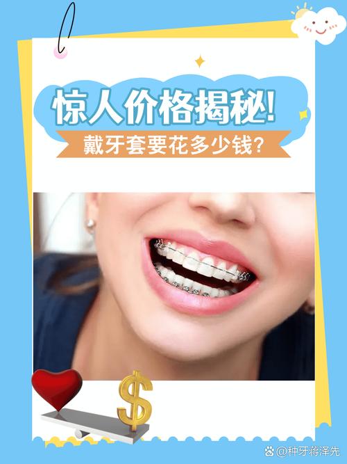 矫正牙齿透明牙套到底要花多少钱 看完心里有底