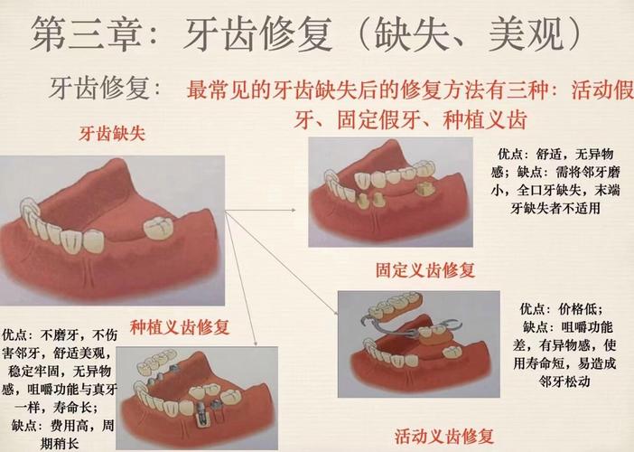 乳牙牙胚缺失_牙齿缺失种植牙_儿童种植牙 乳牙缺失修复方案