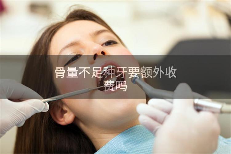深圳罗湖骨量不足全口种牙费用_罗湖种牙哪里最好_罗湖医院种一颗牙要多少钱