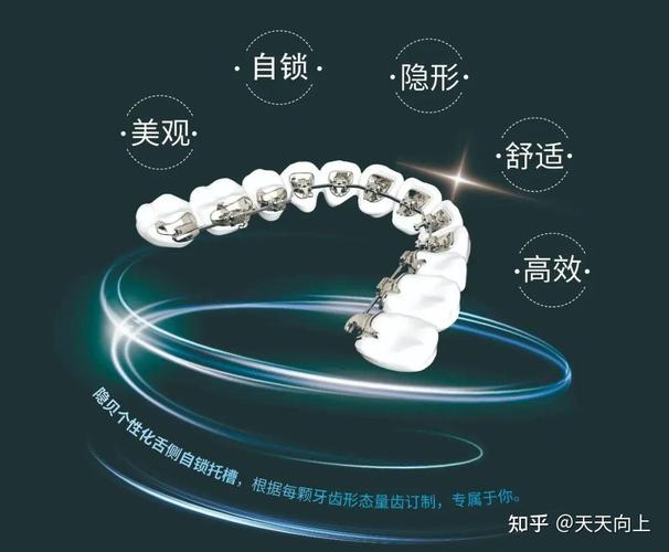 深圳隐形牙齿矫正价格_深圳半隐形矫正医院地址_深圳公立医院隐适美