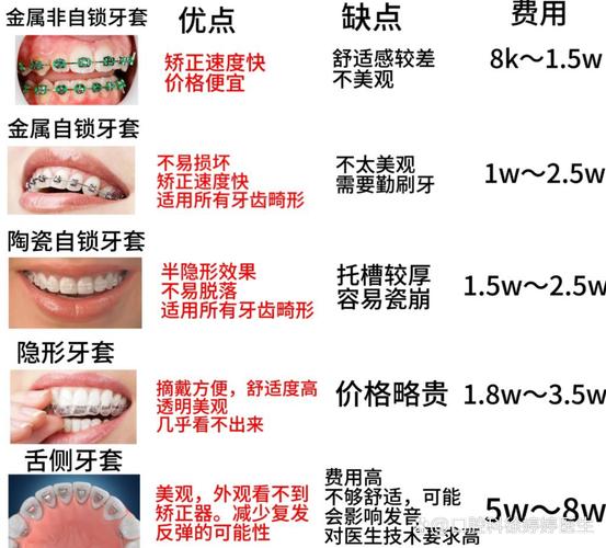 深圳福田青少年做钢丝牙套大概要花多少钱？