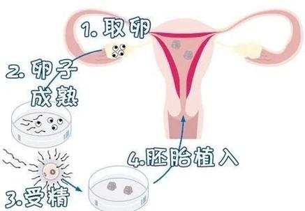 第三代试管婴儿准备多少预算?这笔账你得算明白