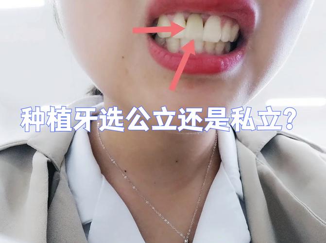 沧浪医院私立公立_通化种植牙医院 公立私立对比_常春藤名校是公立还是私立