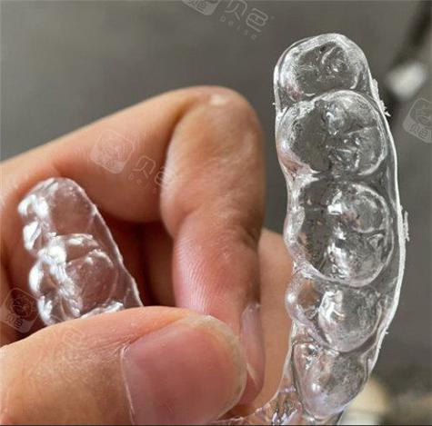 深圳最厉害的隐适美医生_深圳龙华国产隐形矫正性价比牙科_深圳隐形牙套多少钱